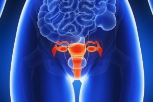 ¿Puede la endometriosis repetirse después de la histerectomía?