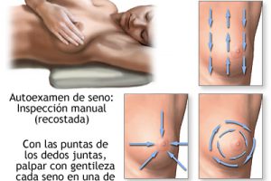 ¿Cómo se siente un tumor de mama?