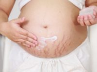 Estrías Negras en el Embarazo: Causas y Solución